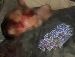 Proyek Betonisasi Jalan Raya Cisoka Memakan Korban, Hadi Saat Ini Kritis Di RSUD Balaraja