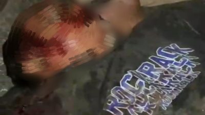 Proyek Betonisasi Jalan Raya Cisoka Memakan Korban, Hadi Saat Ini Kritis Di RSUD Balaraja